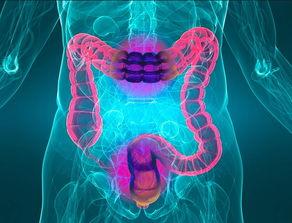 头条问答直肠癌,早期症状、预防与治疗全解析